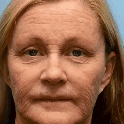 Venofirm Beevenom firming cream